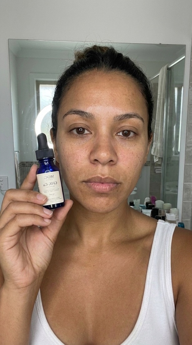 Creator's bare skin on day one — flat, tired-looking and uneven in daylight